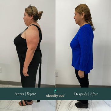 Slider image (6) Obesity Out Bariatric Surgery Center